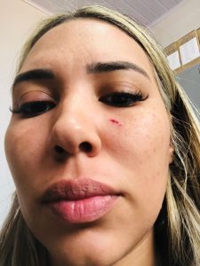 WhatsApp-Image-2024-09-09-at-06.07.33-2-225x300 Tapurah:  Casal troca agressões e esposa agarra testículos para cessar confusão