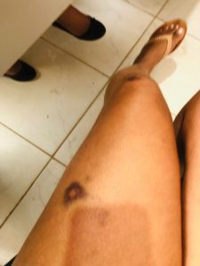 WhatsApp-Image-2024-09-09-at-06.07.33-3-225x300 Tapurah:  Casal troca agressões e esposa agarra testículos para cessar confusão
