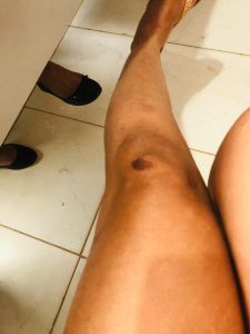 WhatsApp-Image-2024-09-09-at-06.07.34-225x300 Tapurah:  Casal troca agressões e esposa agarra testículos para cessar confusão