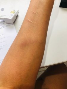 WhatsApp-Image-2024-09-09-at-06.07.35-2-225x300 Tapurah:  Casal troca agressões e esposa agarra testículos para cessar confusão