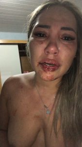 WhatsApp-Image-2024-09-09-at-06.07.35-3-169x300 Tapurah:  Casal troca agressões e esposa agarra testículos para cessar confusão