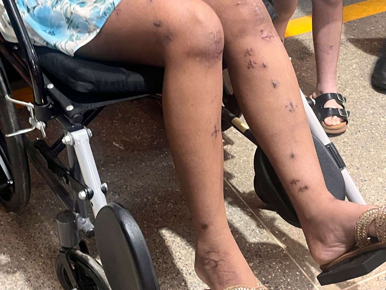 WhatsApp-Image-2025-04-26-at-22.26.41-1 Após sobreviver a acidente grave, mulher retorna ao SAMU de Sorriso para agradecer equipe de socorro