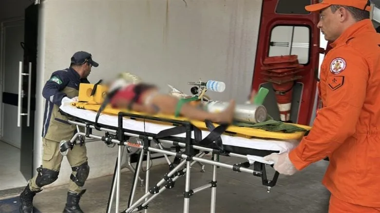 IMG_E1655-1-1024x576-1-780x439-1 Criança atropelada por ônibus em Sorriso sofre traumatismo craniano e fratura exposta