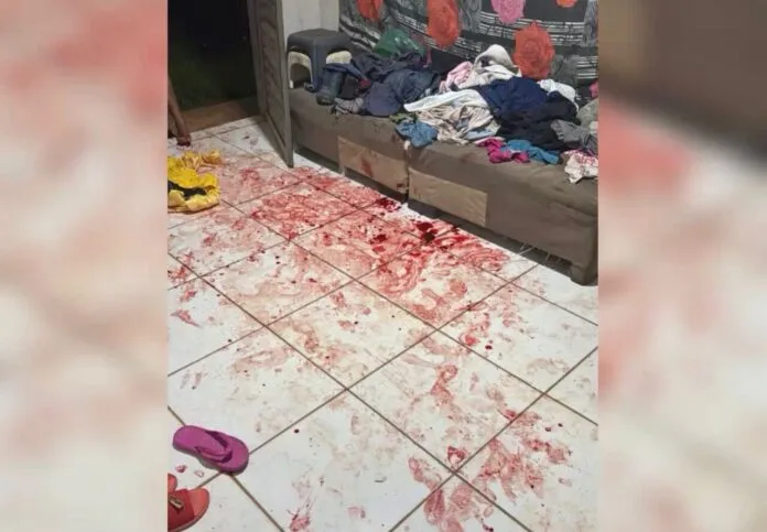 WhatsApp-Image-2025-12-08-at-10.44.09-1280x889-1-696x483-1 Mulher é agredida e esfaqueada pelo ex-marido em Sorriso; suspeito está foragido