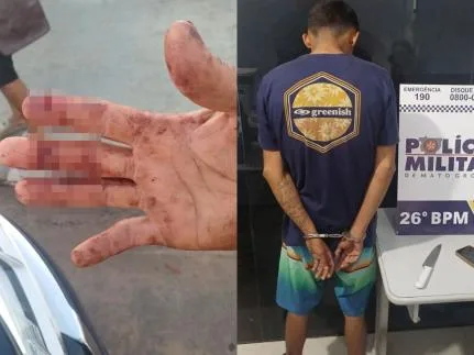 80d830e2db58d8ef0de0125cc06de83b Homem tem os dedos cortados ao defender amiga de roubo em Nova Mutum