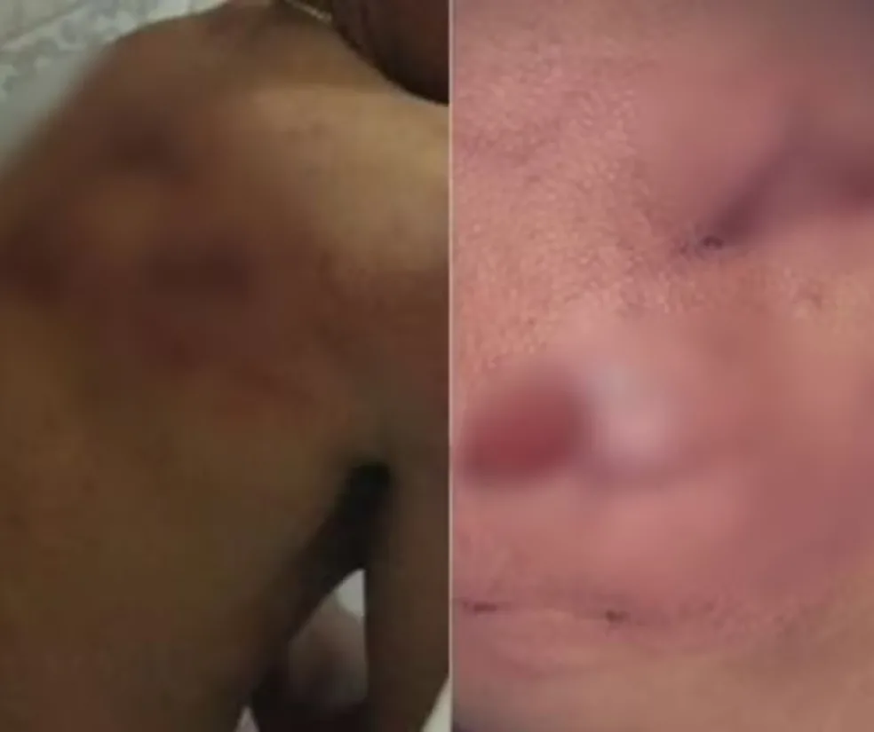 Design-sem-nome-14 Funcionários relatam agressões dentro de alojamento e caso é investigado pela Polícia Civil