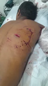 WhatsApp-Image-2026-08-19-at-07.10.15-169x300 Mulher é presa após esfaquear marido enquanto ele dormia em Sorriso